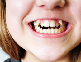 Be Aware Of Oral Health Problems Unique To Your Children