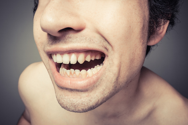 The Effects of Poor Dental Hygiene on Your Body: Halitosis