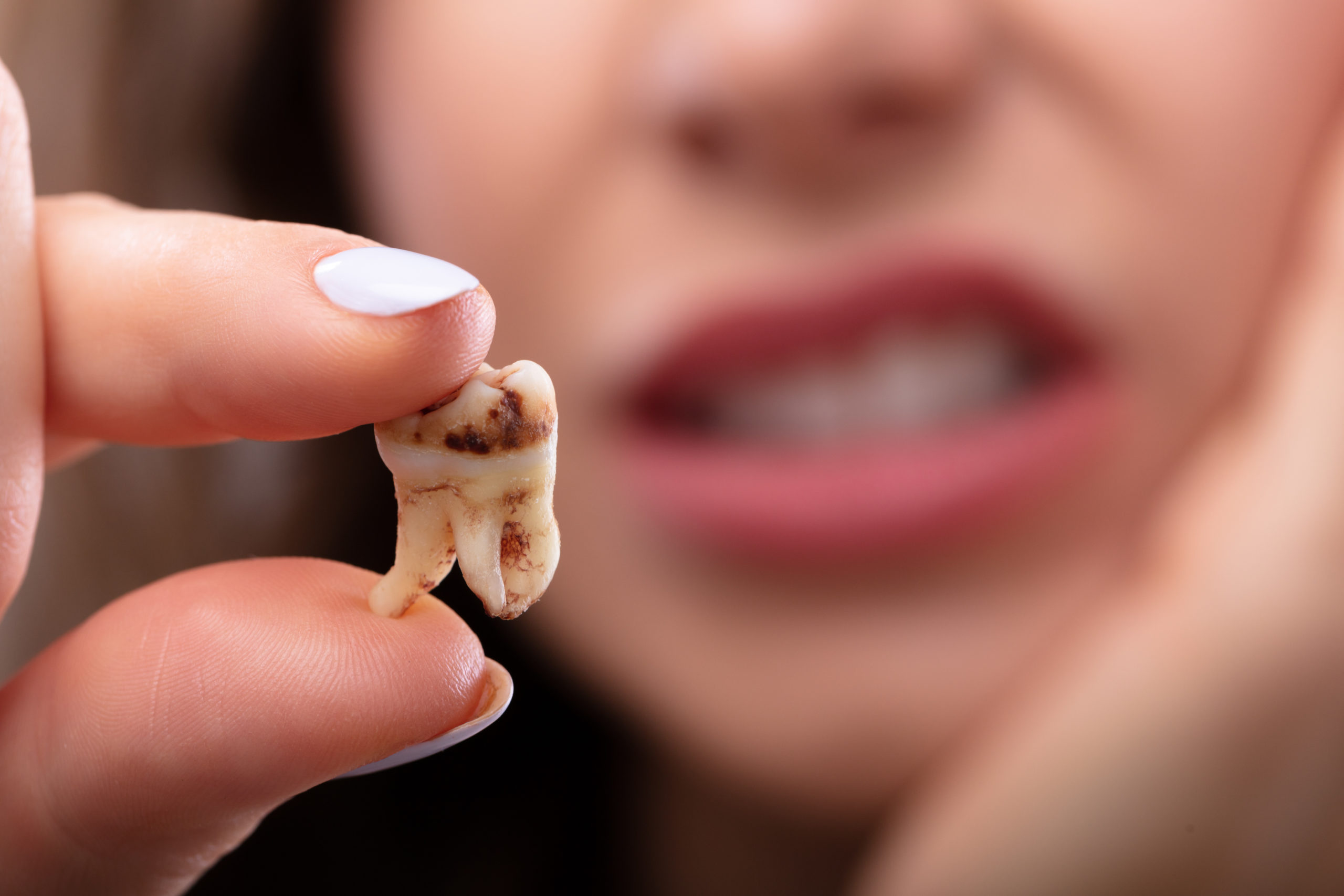 Why Don T Teeth Decay After Death